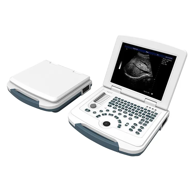 Full-digital Laptop Ultrasound Scanner Portable B/W Ultrasound Machines for hospital